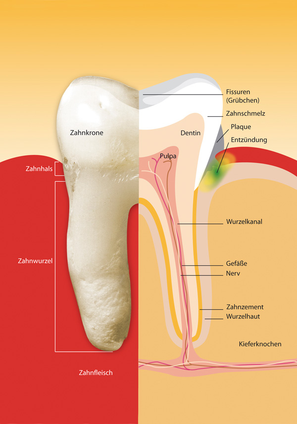 Parodontitis wirkt sich auf den ganzen Körper aus
